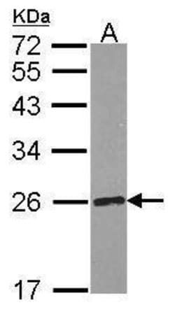 Invitrogen Ribulose-phosphate 3-epimerase Polyclonal Antibody 100 &mu;L;