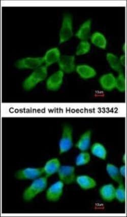 Invitrogen RPL3 Polyclonal Antibody 100 &mu;L; Unconjugated:Antibodies,