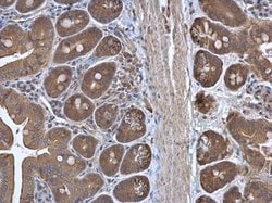Invitrogen RPL3 Polyclonal Antibody 100 &mu;L; Unconjugated:Antibodies,