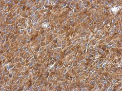 Invitrogen RPL9 Polyclonal Antibody 100 &mu;L; Unconjugated:Antibodies,