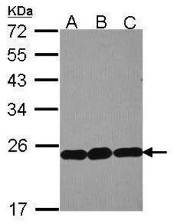 Invitrogen RPL9 Polyclonal Antibody 100 &mu;L; Unconjugated:Antibodies,
