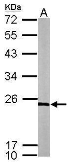 Invitrogen RPL9 Polyclonal Antibody 100 &mu;L; Unconjugated:Antibodies,