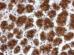 Invitrogen RPLP0 Polyclonal Antibody 100 &mu;L; Unconjugated:Antibodies,