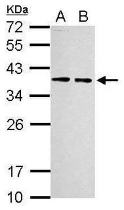 Invitrogen RPLP0 Polyclonal Antibody 100 &mu;L; Unconjugated:Antibodies,
