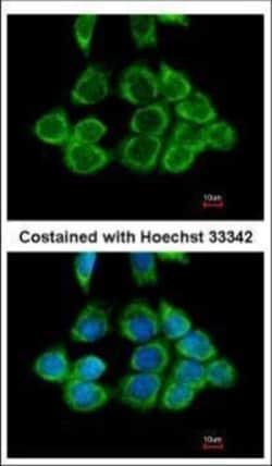 Invitrogen RPS2 Polyclonal Antibody 100 &mu;L | Buy Online | Invitrogen&trade; | Fisher Scientific