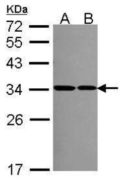 Invitrogen RPS2 Polyclonal Antibody 100 &mu;L | Buy Online | Invitrogen&trade; | Fisher Scientific