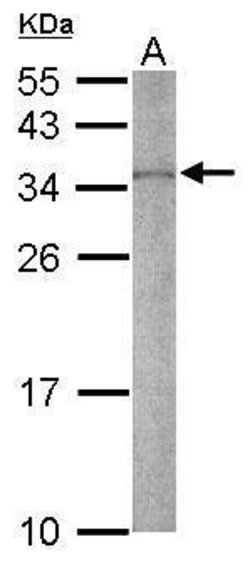 Invitrogen RPS2 Polyclonal Antibody 100 &mu;L | Buy Online | Invitrogen&trade; | Fisher Scientific