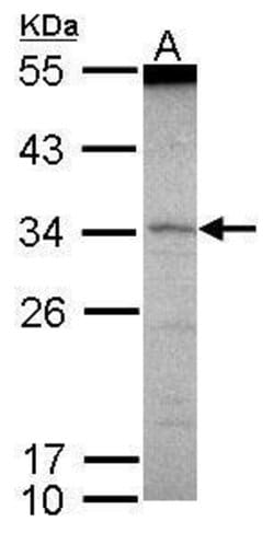Invitrogen SCML1 Polyclonal Antibody 100 &mu;L | Buy Online | Invitrogen&trade; | Fisher Scientific
