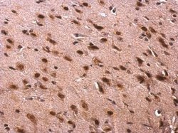 Invitrogen SFRS10 Polyclonal Antibody 100 &mu;L; Unconjugated:Antibodies,