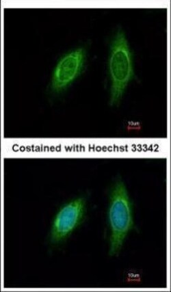 Invitrogen SGTA Polyclonal Antibody 100 μL; Unconjugated:Antibodies,