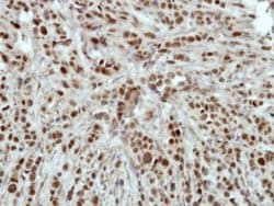 Invitrogen HLTF Polyclonal Antibody 100 &mu;L; Unconjugated:Antibodies,