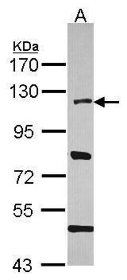 Invitrogen HLTF Polyclonal Antibody 100 &mu;L; Unconjugated:Antibodies,