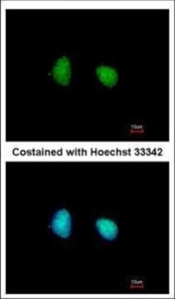 Invitrogen SMARCD1 Polyclonal Antibody 100 &mu;L; Unconjugated:Antibodies,