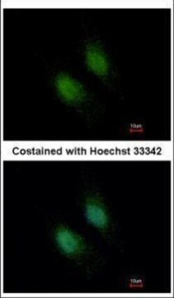 Invitrogen Unc18-2 Polyclonal Antibody 100 &mu;L | Buy Online | Invitrogen&trade; | Fisher Scientific