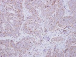 Invitrogen Unc18-2 Polyclonal Antibody 100 &mu;L | Buy Online | Invitrogen&trade; | Fisher Scientific