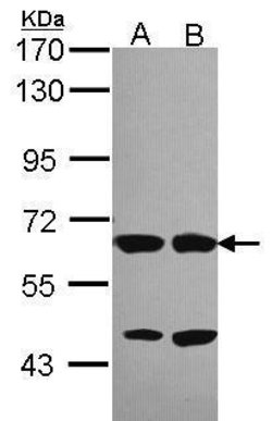 Invitrogen Unc18-2 Polyclonal Antibody 100 &mu;L | Buy Online | Invitrogen&trade; | Fisher Scientific