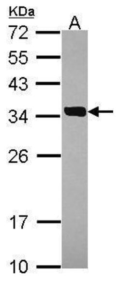 Invitrogen SULT2A1 Polyclonal Antibody 100 &mu;L; Unconjugated:Antibodies,