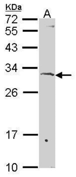 Invitrogen SURF1 Polyclonal Antibody 100 &mu;L; Unconjugated:Antibodies,