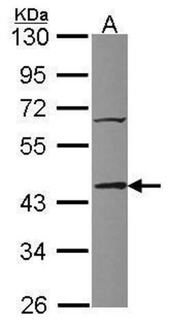 Invitrogen TIAL1 Polyclonal Antibody 100 &mu;L | Buy Online | Invitrogen&trade; | Fisher Scientific