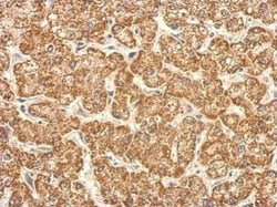 Invitrogen TST Polyclonal Antibody 100 μL; Unconjugated:Antibodies,