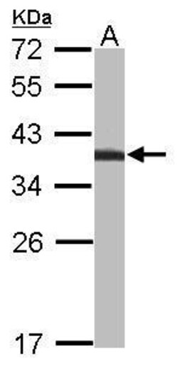 Invitrogen TST Polyclonal Antibody 100 μL; Unconjugated:Antibodies,