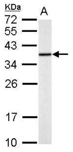 Invitrogen TST Polyclonal Antibody 100 μL; Unconjugated:Antibodies,