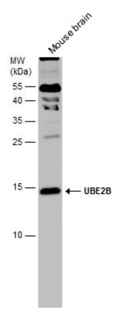 Invitrogen UBE2B Polyclonal Antibody 100 &mu;L; Unconjugated:Antibodies,