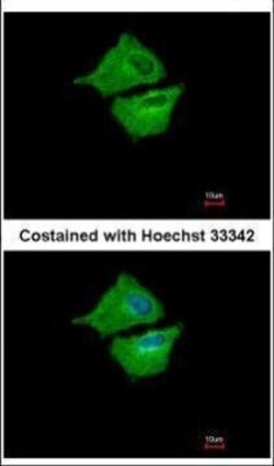 Invitrogen UBE2G1 Polyclonal Antibody 100 &mu;L | Buy Online | Invitrogen&trade; | Fisher Scientific