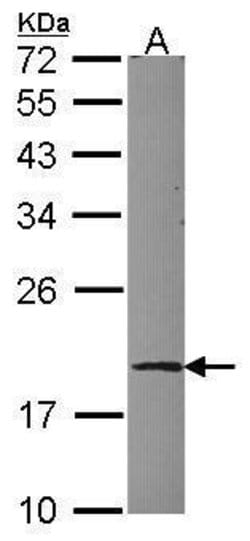 Invitrogen UBE2G1 Polyclonal Antibody 100 &mu;L; Unconjugated:Antibodies,