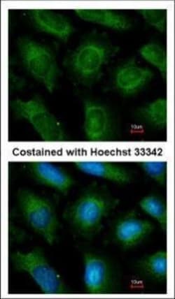 Invitrogen UBE2L3 Polyclonal Antibody 100 &mu;L; Unconjugated:Antibodies,