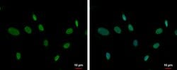 Invitrogen ZNF74 Polyclonal Antibody 100 &mu;L; Unconjugated:Antibodies,
