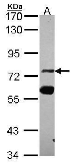 Invitrogen ZNF74 Polyclonal Antibody 100 &mu;L; Unconjugated:Antibodies,