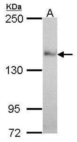 Invitrogen Nardilysin Polyclonal Antibody 100 &mu;L; Unconjugated:Antibodies,