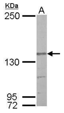 Invitrogen Nardilysin Polyclonal Antibody 100 &mu;L; Unconjugated:Antibodies,