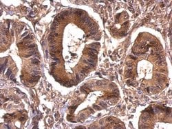 Invitrogen eIF4A1 Polyclonal Antibody 100 &mu;L; Unconjugated:Antibodies,