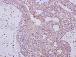 RPL6 Polyclonal Antibody, Invitrogen 100 &mu;L; Unconjugated:Antibodies,