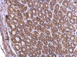 RPL6 Polyclonal Antibody, Invitrogen 100 &mu;L; Unconjugated:Antibodies,