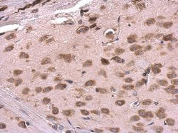RPL6 Polyclonal Antibody, Invitrogen 100 &mu;L; Unconjugated:Antibodies,