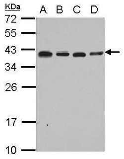 RPL6 Polyclonal Antibody, Invitrogen 100 &mu;L; Unconjugated:Antibodies,