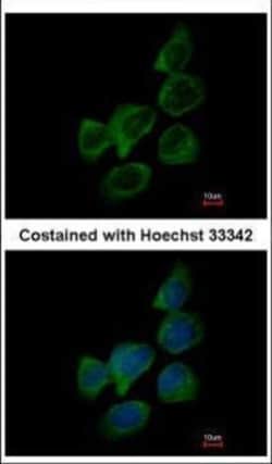 Invitrogen Aldolase B Polyclonal Antibody 100 &mu;L | Buy Online | Invitrogen&trade; | Fisher Scientific