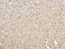 Invitrogen Aldolase B Polyclonal Antibody 100 &mu;L | Buy Online | Invitrogen&trade; | Fisher Scientific