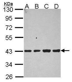 Invitrogen Aldolase B Polyclonal Antibody 100 &mu;L | Buy Online | Invitrogen&trade; | Fisher Scientific