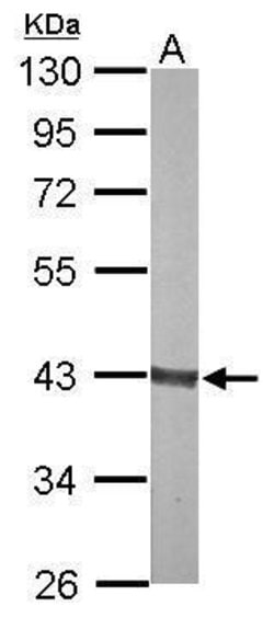 Invitrogen Aldolase B Polyclonal Antibody 100 &mu;L | Buy Online | Invitrogen&trade; | Fisher Scientific