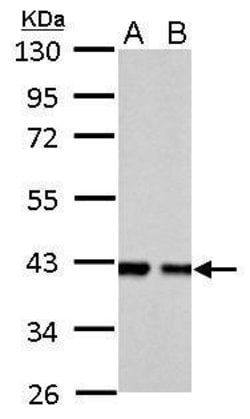 Invitrogen Aldolase B Polyclonal Antibody 100 &mu;L | Buy Online | Invitrogen&trade; | Fisher Scientific