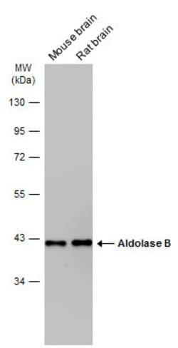 Invitrogen Aldolase B Polyclonal Antibody 100 &mu;L | Buy Online | Invitrogen&trade; | Fisher Scientific