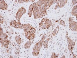 Invitrogen PCK2 Polyclonal Antibody 100 &mu;L; Unconjugated:Antibodies,
