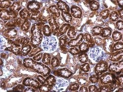 Invitrogen SNRPN Polyclonal Antibody 100 &mu;L; Unconjugated:Antibodies,