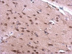 Invitrogen SNRPN Polyclonal Antibody 100 &mu;L; Unconjugated:Antibodies,