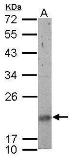 Invitrogen SNRPN Polyclonal Antibody 100 &mu;L; Unconjugated:Antibodies,