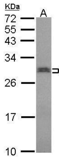 Invitrogen SNRPN Polyclonal Antibody 100 &mu;L; Unconjugated:Antibodies,